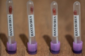 abc-abd-hantavirus-vakalarini-3-seviye-acil-durum-koduyla-takibe-aldi-lSNu85Px.jpg