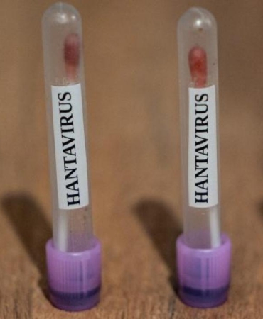 abc-abd-hantavirus-vakalarini-3-seviye-acil-durum-koduyla-takibe-aldi-lSNu85Px.jpg