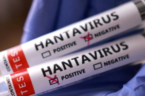 dunya-saglik-orgutu-baskanindan-hantavirus-mesaji-bu-yeni-bir-covid-19-degil-IJPYy1i4.jpg