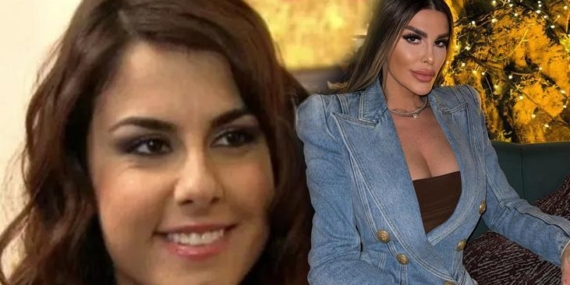 eski-halini-unutun-tugce-ozbudak-estetik-ameliyatlari-sonrasi-bambaska-biri-oldu-1MXijmSQ.jpg