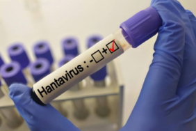 grip-ile-karistiriliyor-uzmanlardan-hantavirus-aciklamasi-4F5HPwj3.jpg