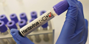 grip-ile-karistiriliyor-uzmanlardan-hantavirus-aciklamasi-4F5HPwj3.jpg