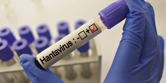 grip-ile-karistiriliyor-uzmanlardan-hantavirus-aciklamasi-4F5HPwj3.jpg