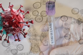 hantavirus-bir-ulkeye-daha-sicradi-birkac-ay-once-dogu-avrupadaymis-IfrO4yVc.jpg
