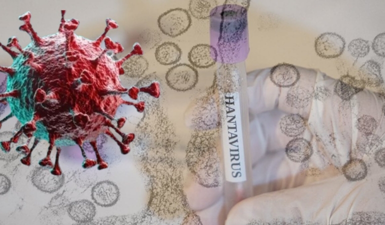 hantavirus-bir-ulkeye-daha-sicradi-birkac-ay-once-dogu-avrupadaymis-IfrO4yVc.jpg