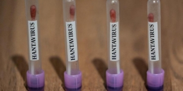 hantavirus-icin-abd-teyakkuzda-3-seviye-acil-durum-eapzz5FJ.jpg