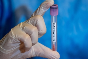 hantavirus-sonrasi-dunya-diken-ustunde-pandemiye-donusur-mu-turkiyede-de-gorulmustu-PMhLEv4p.jpg