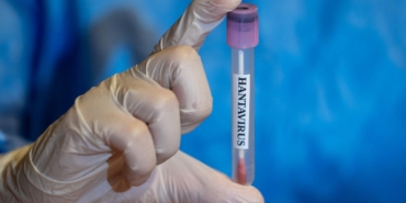 hantavirus-sonrasi-dunya-diken-ustunde-pandemiye-donusur-mu-turkiyede-de-gorulmustu-PMhLEv4p.jpg