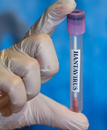 hantavirus-sonrasi-dunya-diken-ustunde-pandemiye-donusur-mu-turkiyede-de-gorulmustu-PMhLEv4p.jpg