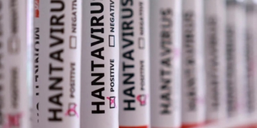 herkesin-aklinda-tek-soru-hantavirus-insandan-insana-bulasir-mi-U8DwWP7O.jpg