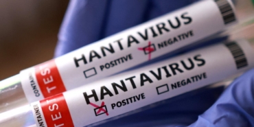 israilde-hantavirus-alarmi-birinci-olay-kaydedildi-hGelmuiB.jpg