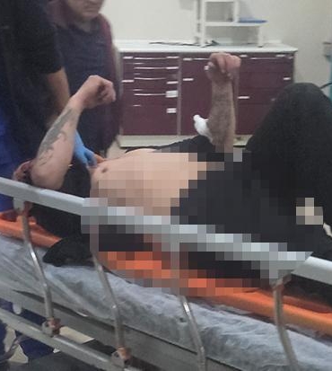 otomobil-elektrik-diregini-devirdi-saniyeler-sonra-gelen-motosiklet-direge-carpti-ortalik-savas-alanina-dondu-YPt7xEO4.jpg