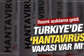 son-dakika-bakanliktan-hantavirus-aciklamasi-tespit-edilmedi-aJ4HEkYA.jpg